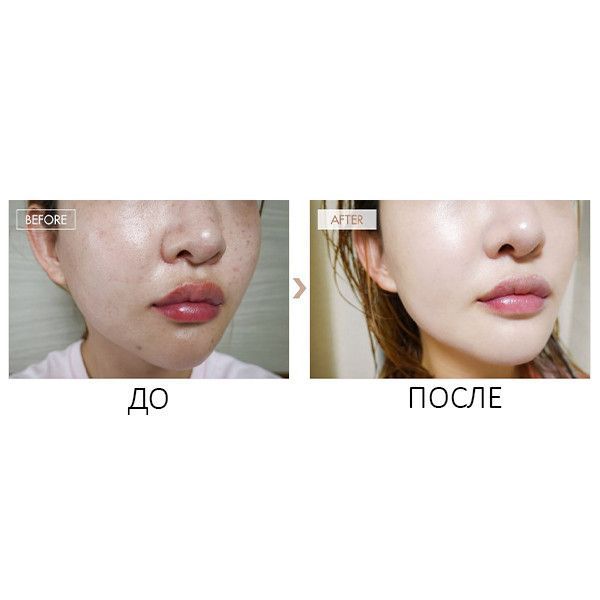 Стійкий ББ крем-бальзам з матовим фінішем Dr.Ceuracle Recovery BB Balm SPF 28 PA ++, 45 мл 8806133613979 фото