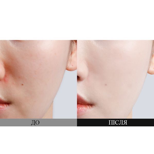 Сонцезахисний освітлюючий крем з пробіотиками Dr. Ceuracle Pro Balance Biotics Clear Up Sun SPF 50+ PA++++, 50 мл 8806133614884 фото