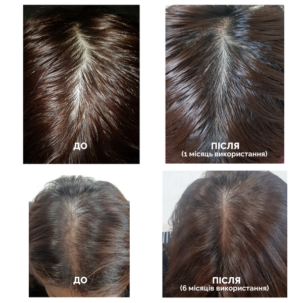 Стимулюючий тонік для росту волосся Dr.FORHAIR Folligen Tonic, 120мл 8809485531502 фото
